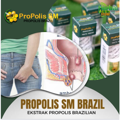 Obat Penghilang Sakit Anus,Pereda Nyeri,Perih, Benjolan, Bengkak | Obat Herbal Wasir, Fissura Ani, F