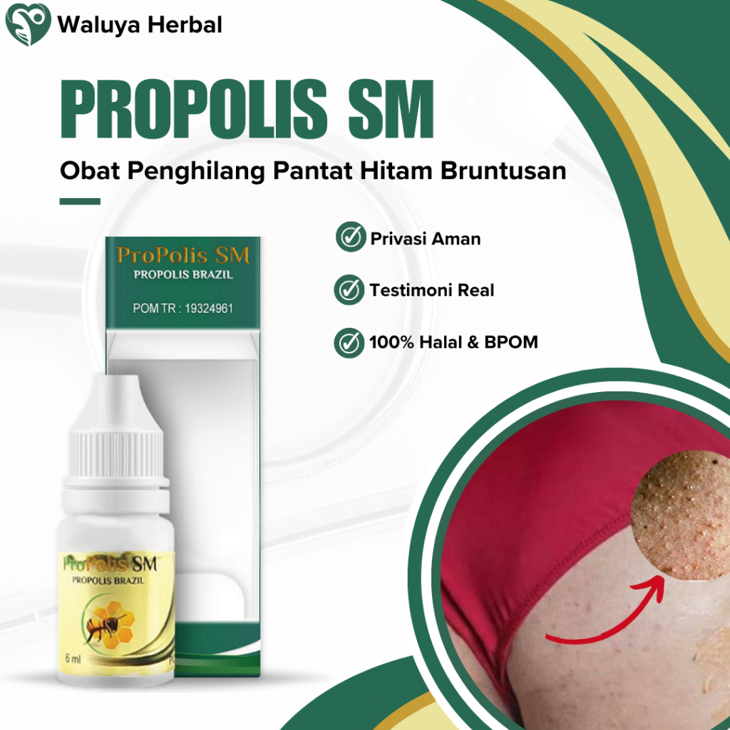 Obat Penghilang Pantat Gatal dan Hitam Pembersih Korengan di Pantat, Penghilang Bekas Luka Hitam di 