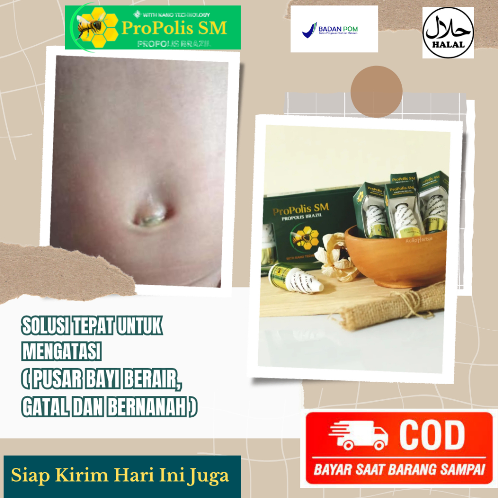 Obat Tali Pusar Berair, Obat Pusar Gatal , Obat Pusar Bengkak, Obat Infeksi Tali Pusar Bayi, Obat Pu