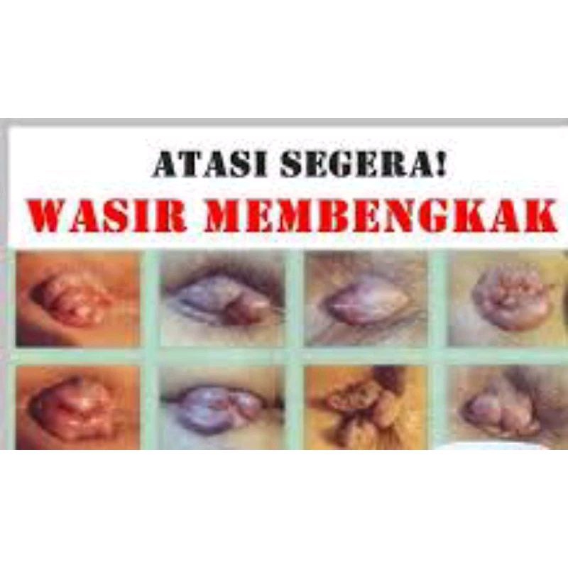 

ambien tuntas boreh rempah kempeskan ambien kyloit