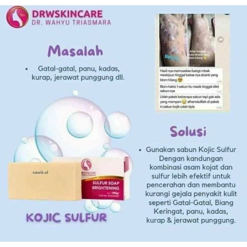 Sulfur Soap/Kojic sulfur