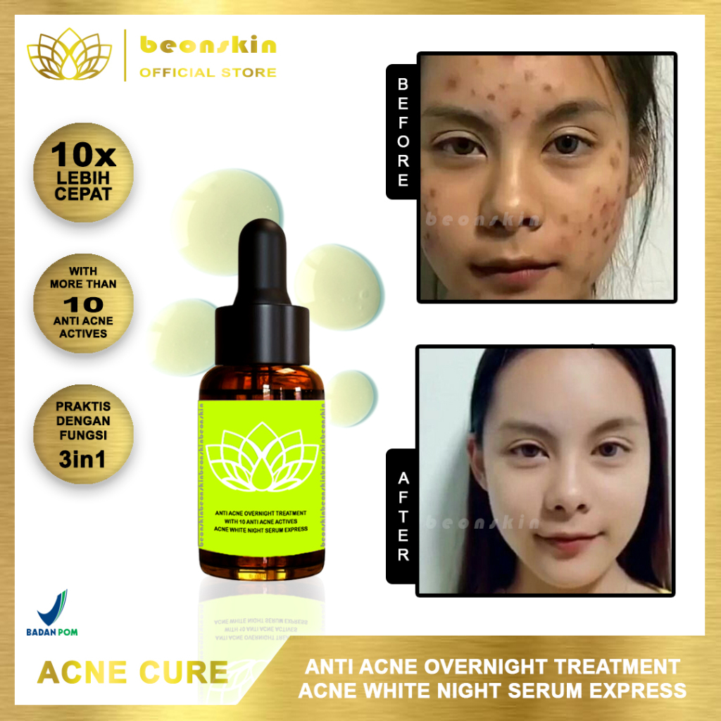 KHUSUS YANG SERIUS MAU SEMBUHKAN JERAWAT SAMPAI TUNTAS | Beonskin BPOM Serum Anti Acne Overnight Tre