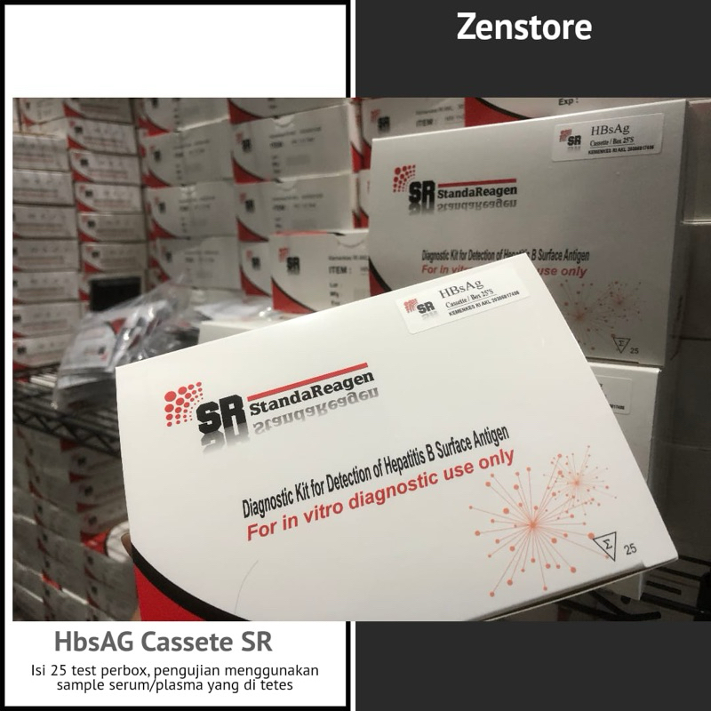 SR Test HbsAG 25 test
