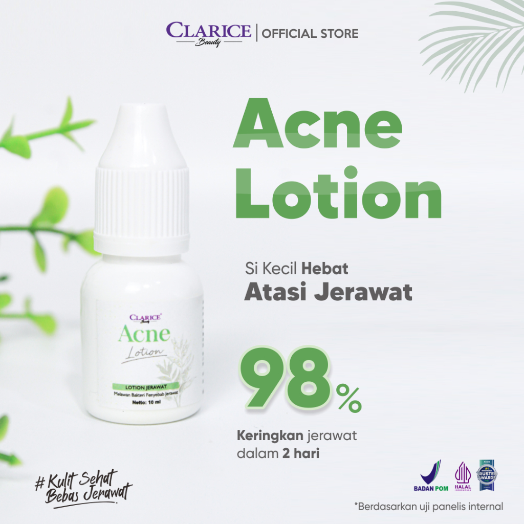 CLARICE BEAUTY Acne Lotion 10ML | Obat Jerawat