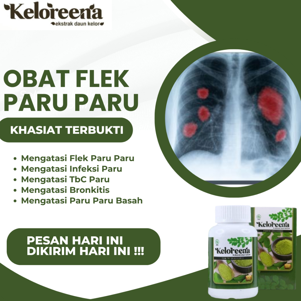 Obat Flek Paru Paru, Infeksi Paru, Tbc Batuk Berdarah, Flek Paru Anak, Pembersih Paru Paru, Bronkiti