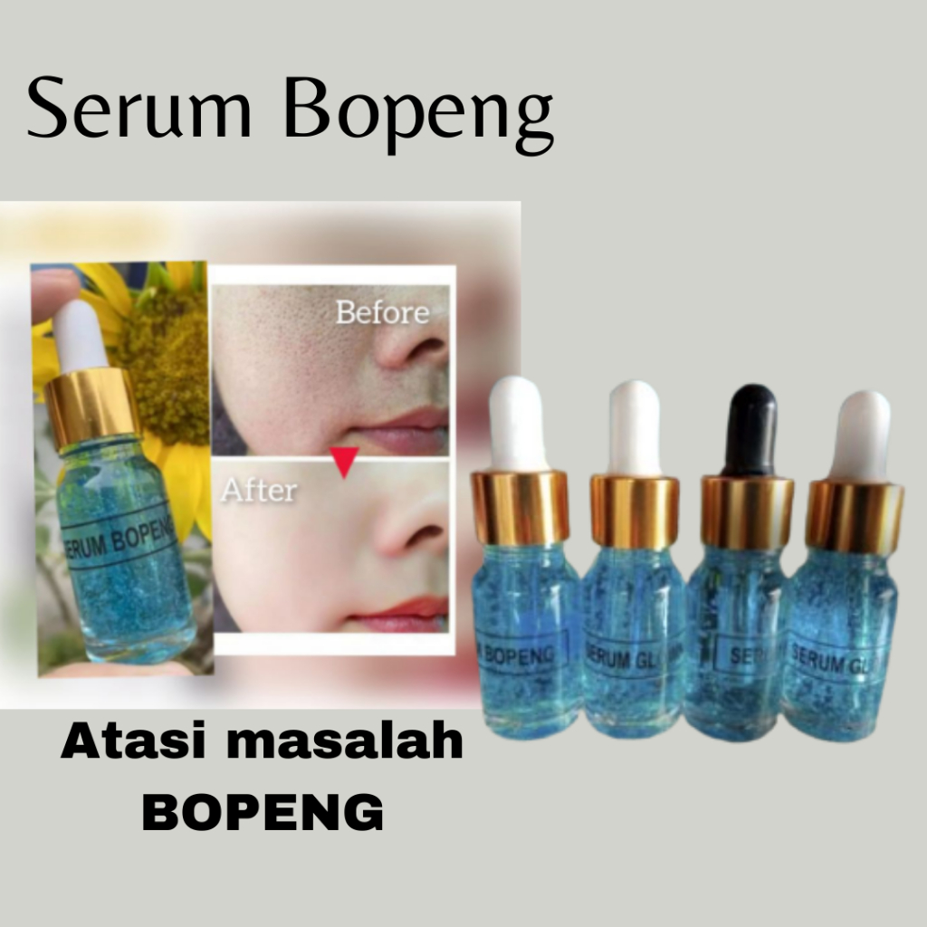 Serum Penghilang Bopeng Ampuh Penghilang Bopeng bekas jerawat flek Hitam serum Bopeng