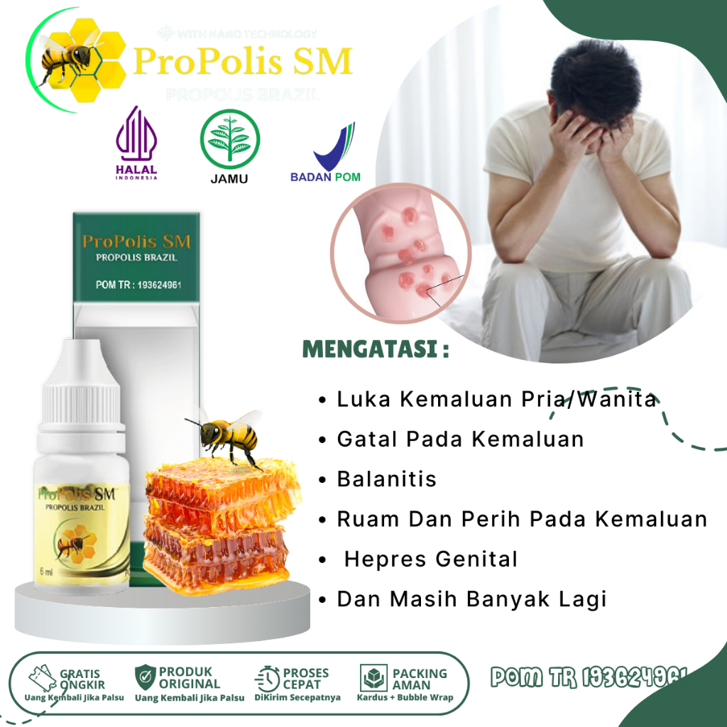 Obat Luka Kemaluan - Salep Luka Lecet Di Kemaluan - Obat Balanitis - Obat Herpes Genital - Obat Irit