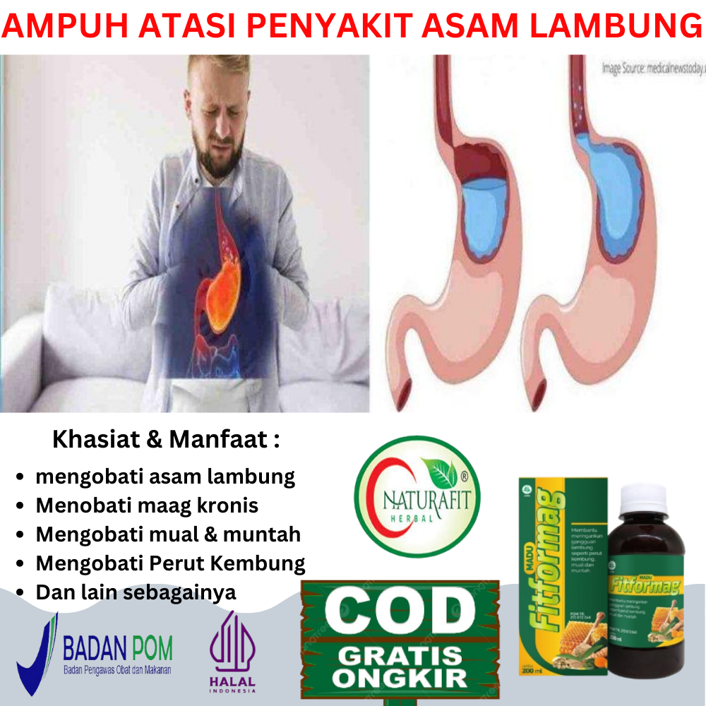 Obat Asam Lambung Paling Manjur Aman Tanpa Epeksamping, Ampuh Atasi Sakit Maag, Maag kronis, Perut k