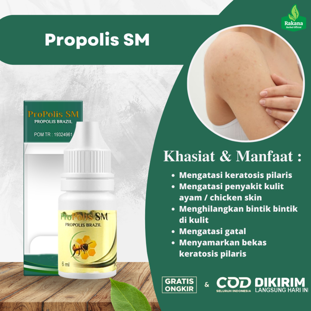 Obat Keratosis Pilaris Penyakit Kulit Ayam Bintik Di Kulit Kasar Dan Kering PALING AMPUH Namun Terga