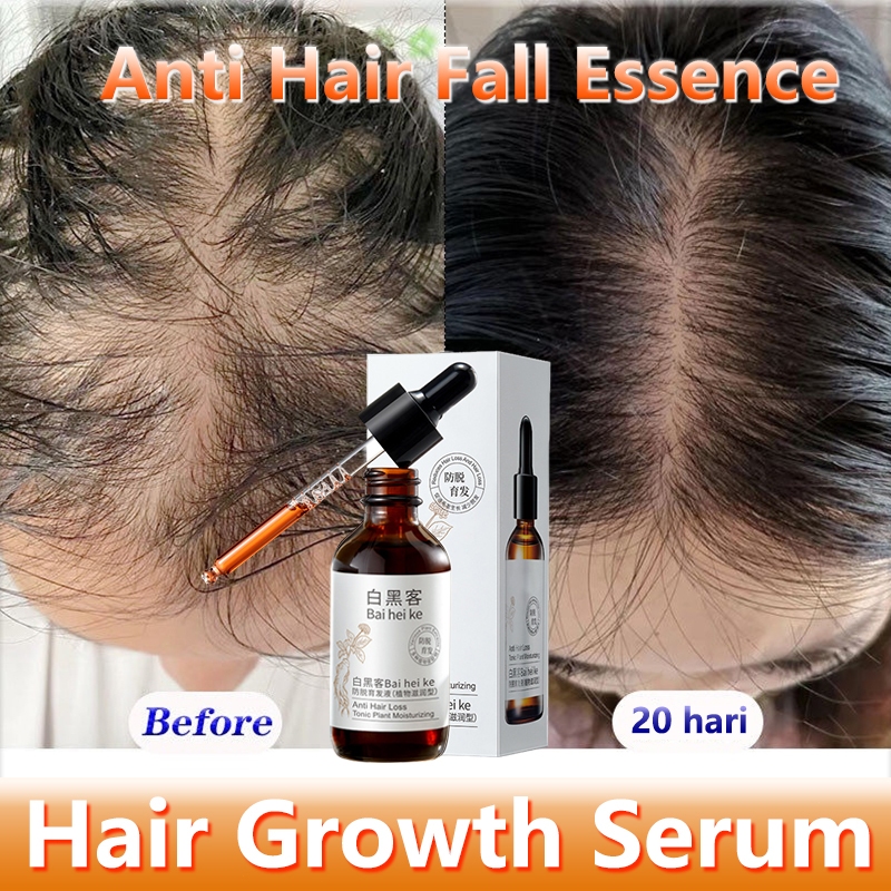 Penumbuh rambut cepat  rambut serum penumbuh 60ml obat penumbuh rambut penumbuh rambut botak Ekstrak