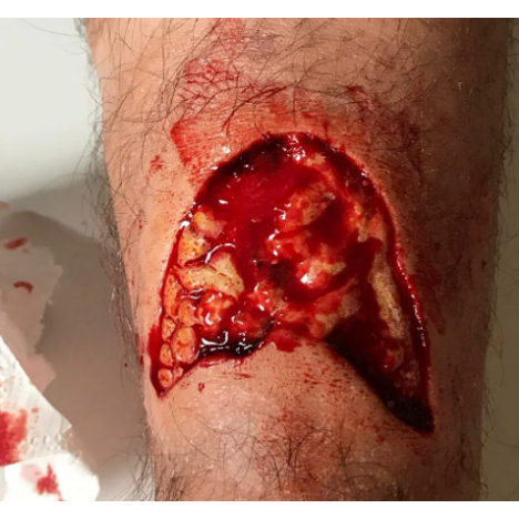 LUKA TERBUKA SILIKON PROSTETIK | LUKA SAYAT PALSU | SFX MAKEUP | CRIME MAKEUP | SILICONE PROSTHETIC 