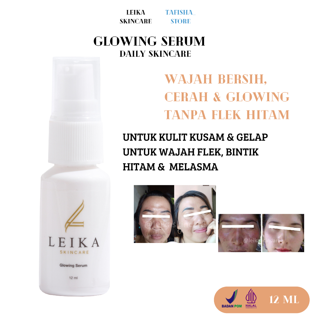 GLOWING SERUM LEIKA SKINCARE Serum Flek Hitam Penghilang Flek Hitam Membandel Skincare Flek Hitam