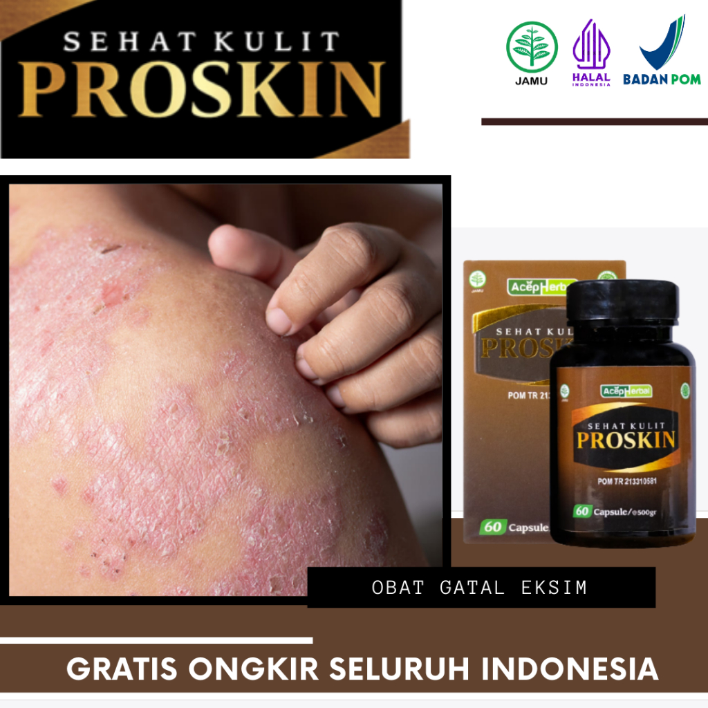 Proskin - Obat Gatal Eksim, Eksim Kering, Eksim Basah, Eksim di Tangan/Kaki, Jamur Kulit, Kulit Keri