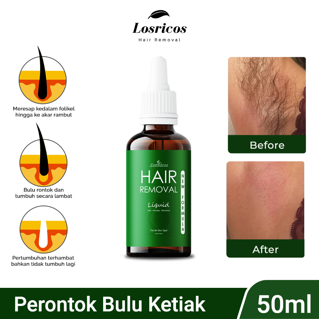 Losricos Wax Perontok Bulu Ketiak Permanen, Hair Removal Liquid Bukan Cream Perontok Bulu BPOM