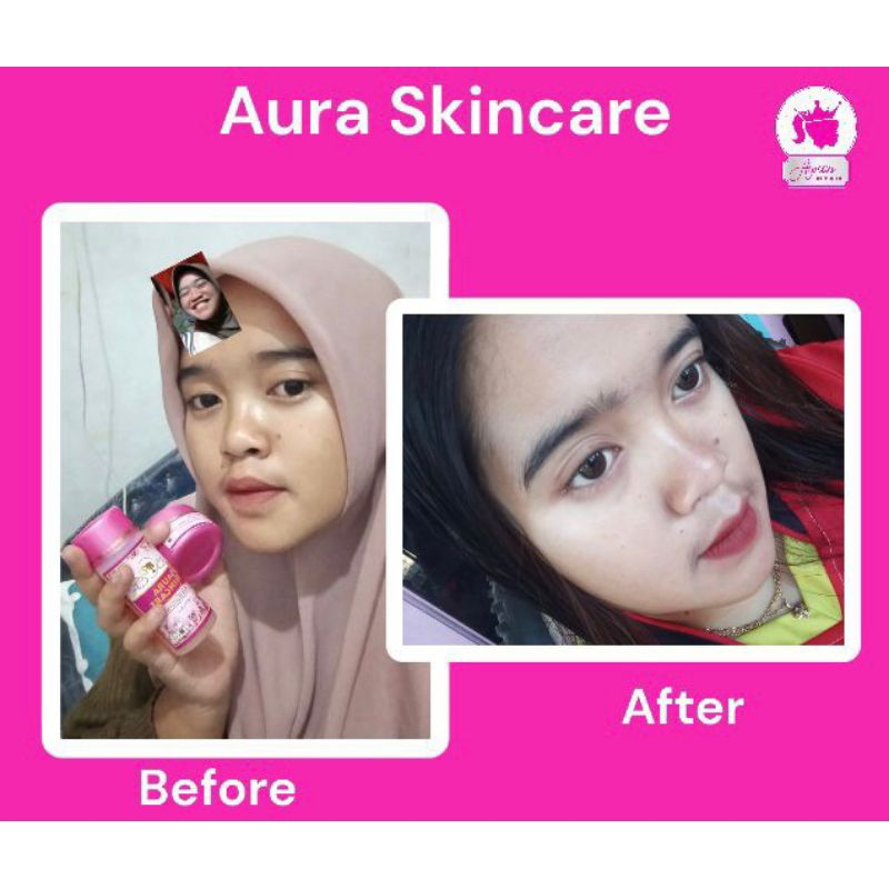 Aura Skincare Paket BOOSTER BPOM free kapas wajah
