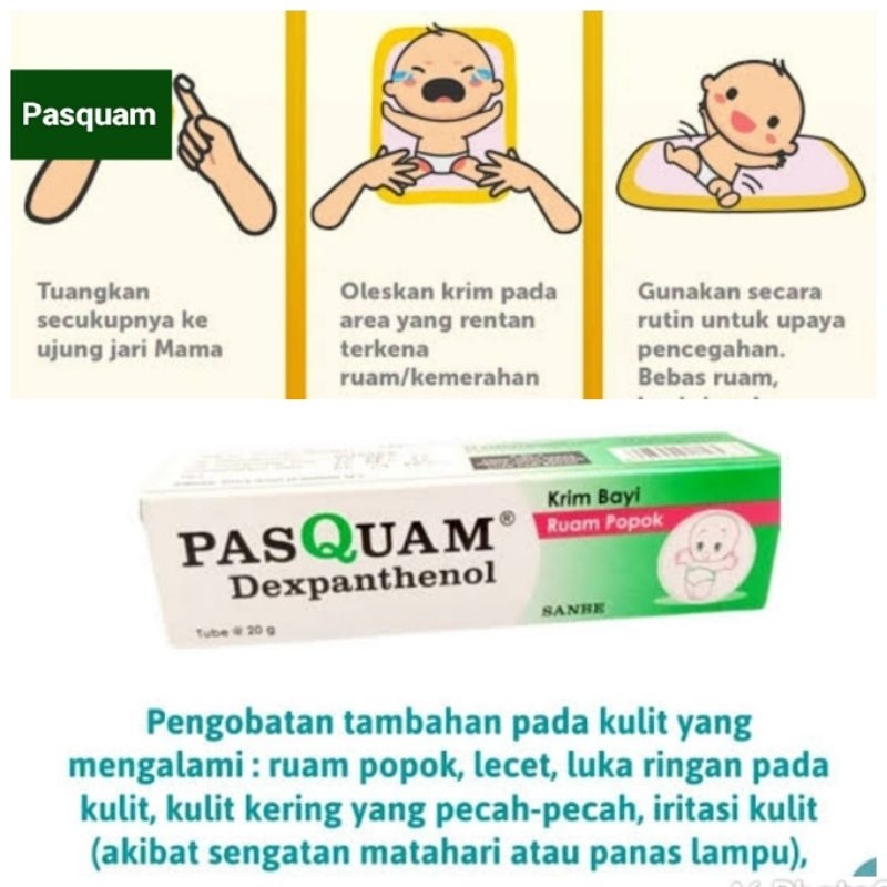 PASQUAM SANBE Diaper Rash/Ruam Popok Ruam Pipi Krim Bayi Diapers