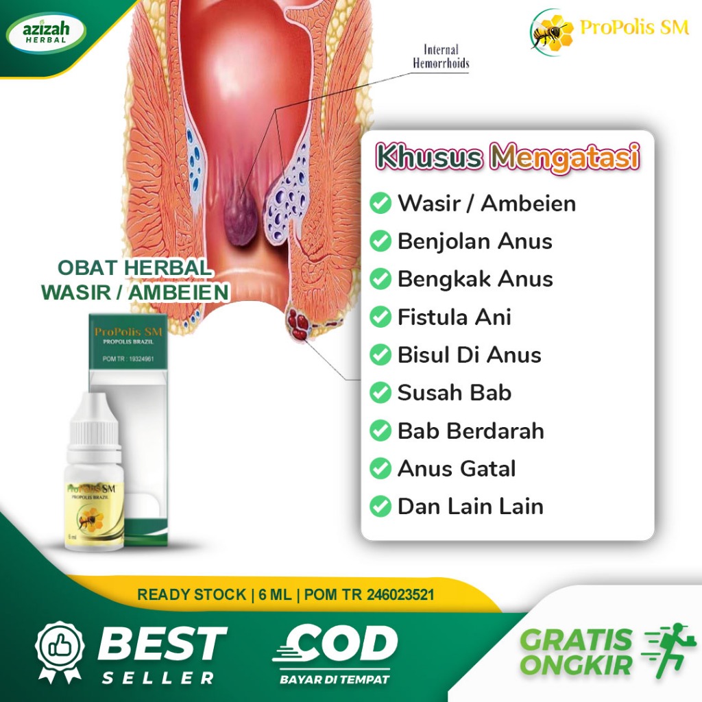 Obat Wasir Stadium 1 Sampai 4 Ambeien Fistula Ani Bab Berdarah Benjolan Di Dubur Propolis SM Brazil