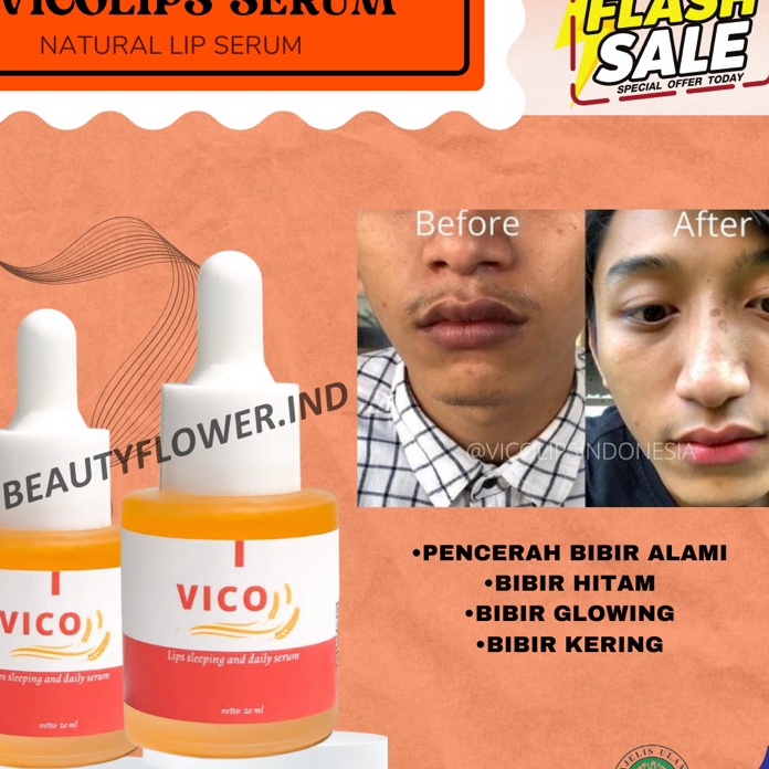 STAR VICO LIPS SERUM BIBIR ORIGINAL  PENCERAH BIBIR  SERUM BIBIR  PEMERAH BIBIR  PEMERAH BIBIR PERMA