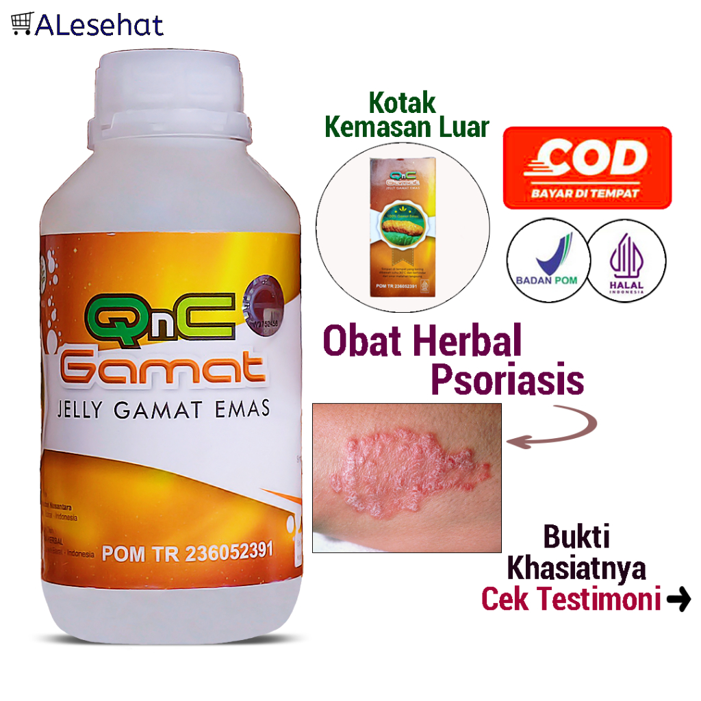 Obat Psoriasis Kulit Kepala, Badan, Wajah & Lutut Qnc Jelly Gamat