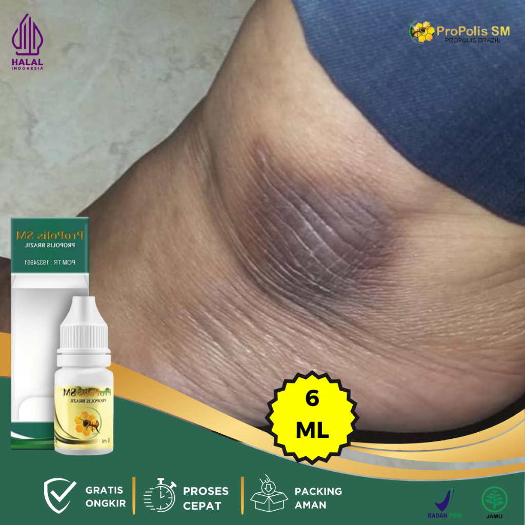 Obat Pemutih Mata Kaki Yang Hitam, Obat Mata Kaki Hitam dan Kasar, Obat Mata Kaki Hitam Kapalan, Oba