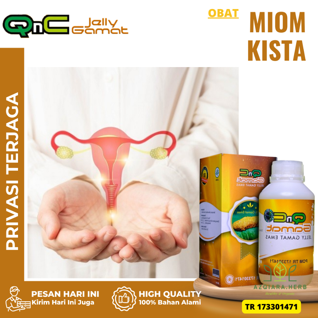 Obat Miom & Kista, Obat Penghancur Kista, Obat Kista, Obat Kista Ovarium, Obat Kista Bartholin, Obat