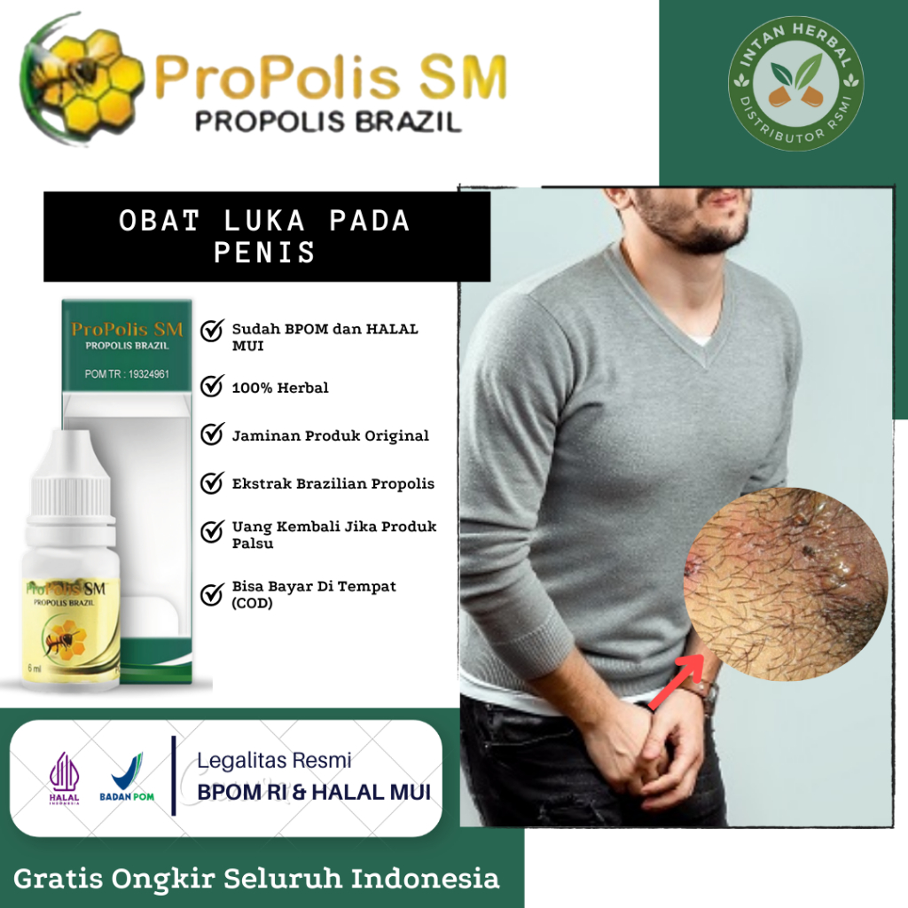 Obat Luka Penis, Penis Bengkak, Luka Pada Kelamin Pria, Luka Batang, Iritasi Pada Kepala Penis, Cand