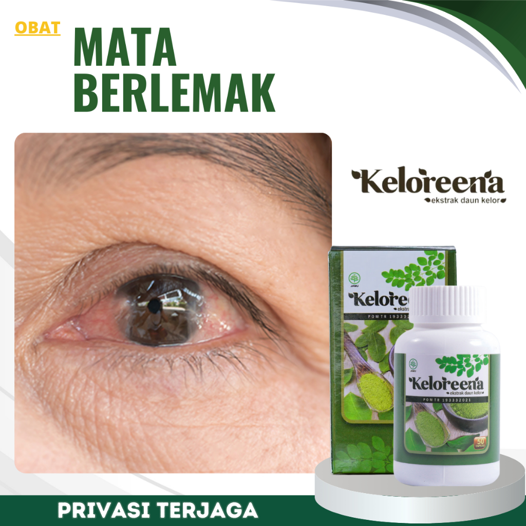Obat Mata Berlemak Ptregium Kekuningan, Obat Mata Berlemak, Obat Pembersih Pterigium, Obat Penghilan