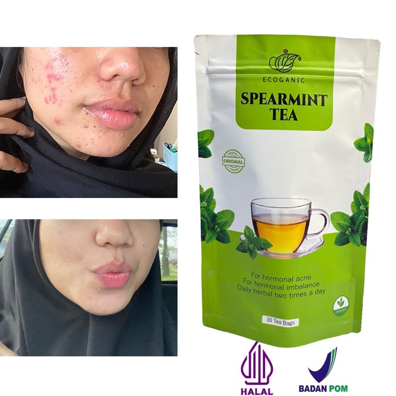 

Terlaris Original Spearmint Tea BPOM PIRT Jerawat Hormonal Isi 3 Kantong