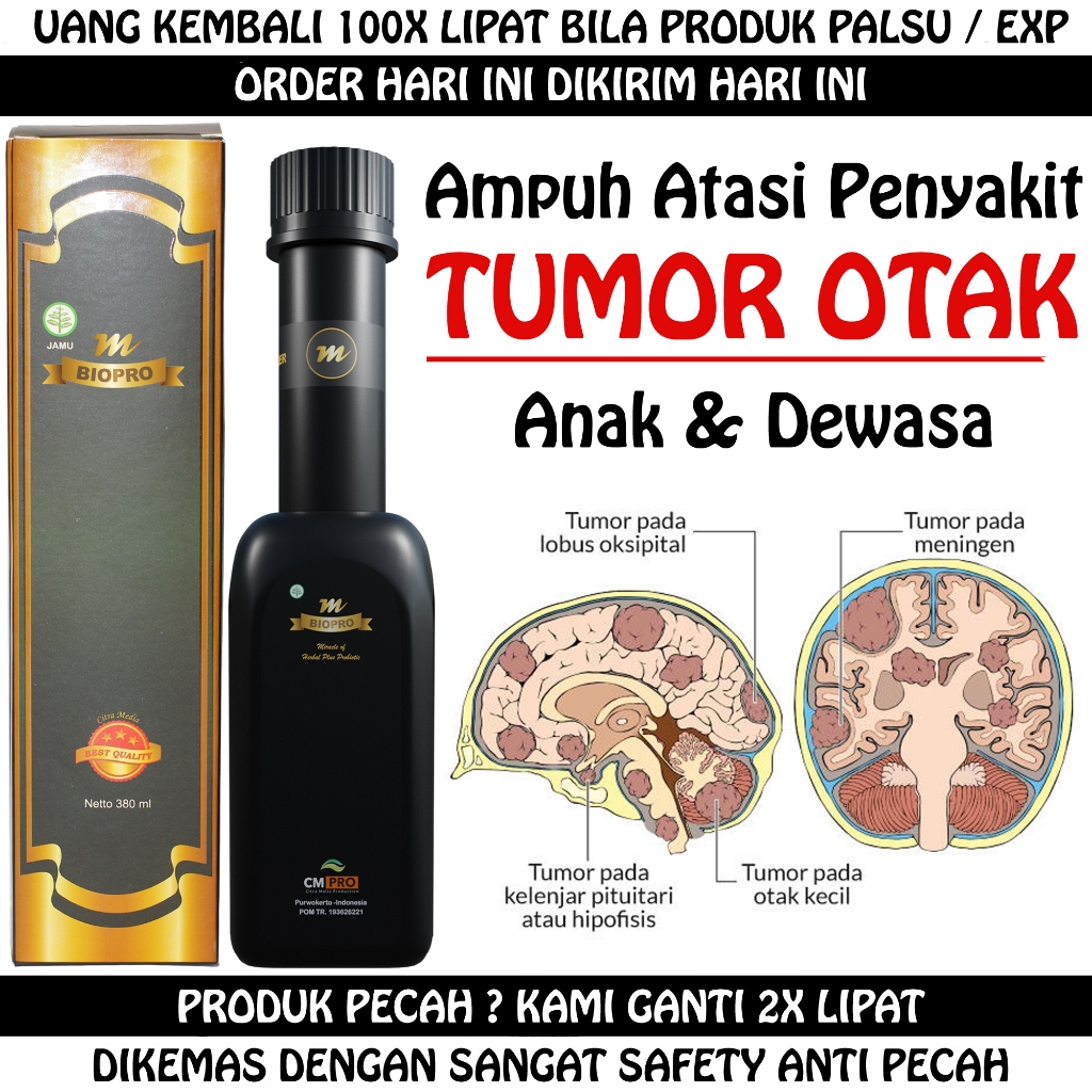 Obat Tumor Otak Ganas Anak & Dewasa Radang Tumor Otak Kecil, Tumor Otak Kronis Paling Ampuh Mbiopro