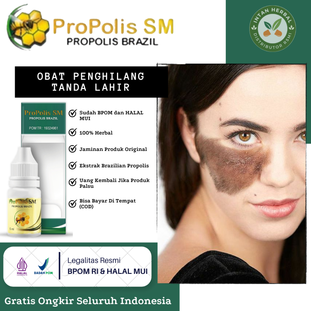 Propolis SM 6ml - Obat Penghilang Tanda Lahir, Tanda Lahir Coklat/Hitam, Memudarkan Tanda Lahir, Tan