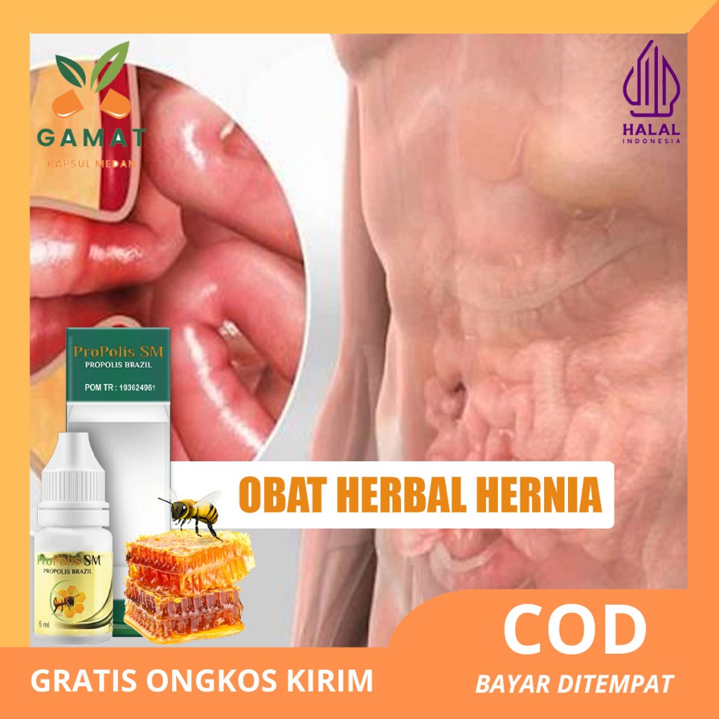 Obat Hernia Turun Berok Varikokel Hidrokel Buah Zakar Bengkak Sebelah Kanan Kiri Cepat Sembuh