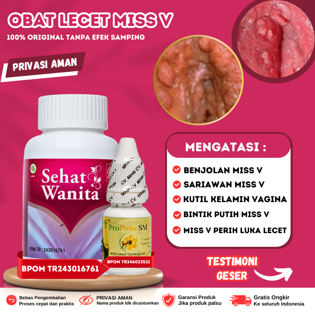 Obat Lecet MIss v,  Obat Miss v Bengkak dan Sakit, Obat Miss V Gatal dan Perih, Luka Lecet Vagina