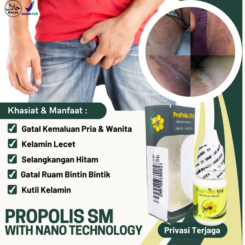 Obat Gatal Kemaluan Pria Dan Wanita Luka Pada Kelamin Kelamin Lecet Infeksi Jamur Kurap Selangkangan