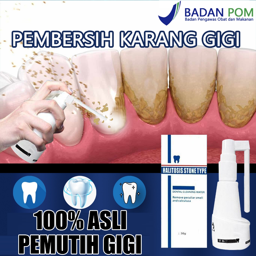 Pembersih karang gigi Penghilang karang gigi membandel alat pembersih karang gigi 30ml pembersih gig