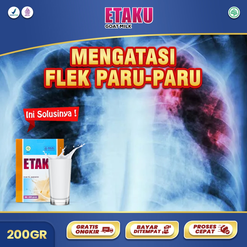 

Susu Plek Paru Paru Anak dan Dewasa Obat TBC Flek Radang Sesak Nafas Asma Nyeri Dada Tuberculosis Bronkitis Batuk
