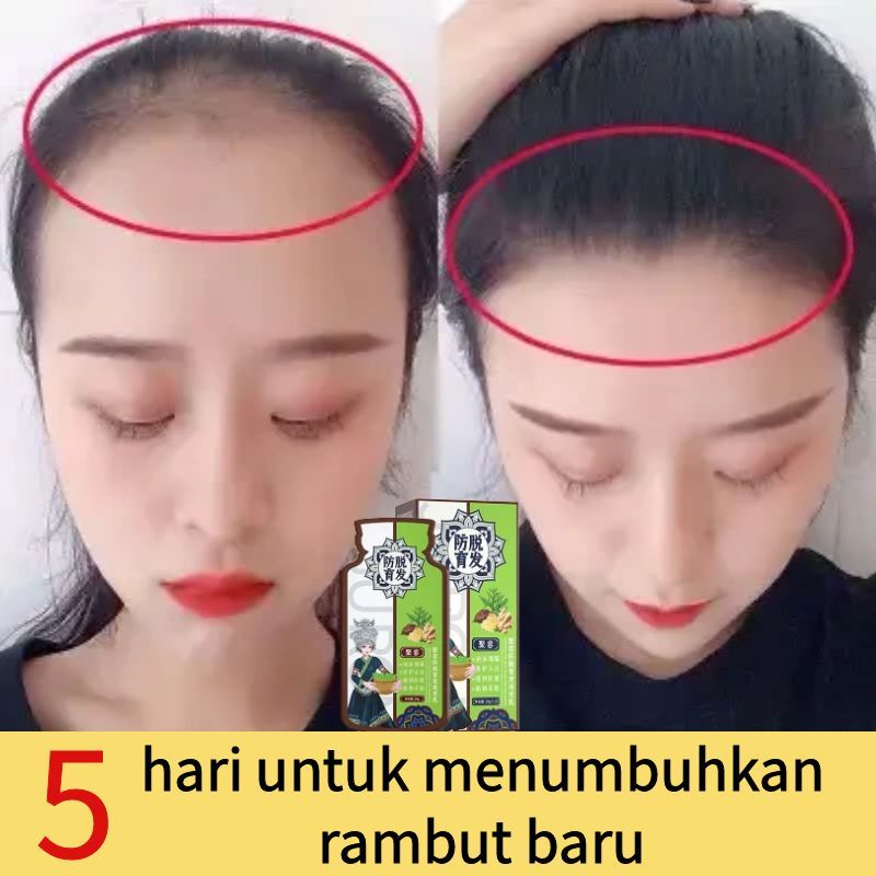 Jahe Shampoo anti ketombe Obat ketombe Sampo anti rontok Sampo anak Sampo murah Alat rambut Shampo A