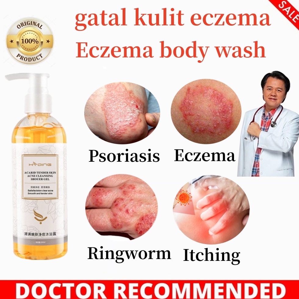 eczema body wash Pengobatan Eksim psoriasis eksim kering Kurap gatal kulit jamur kulit eksim lotion 
