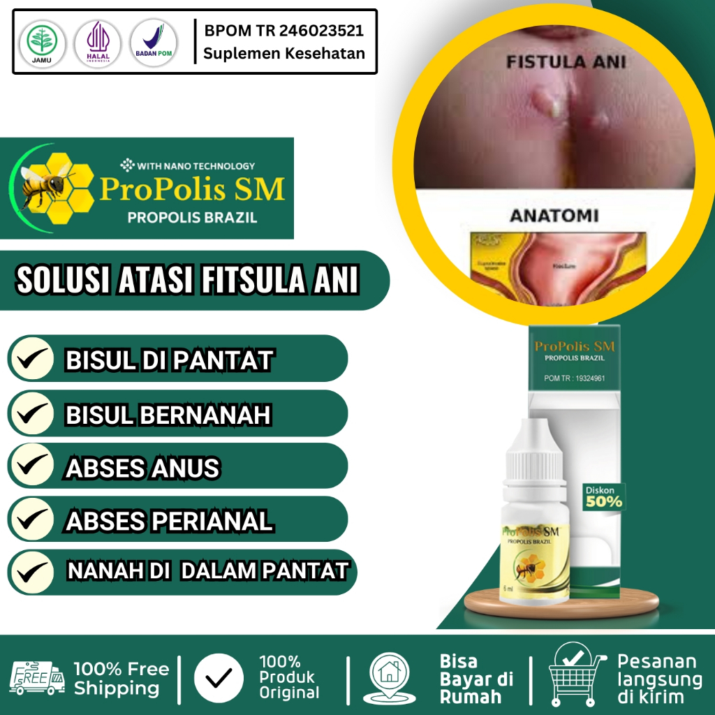 Obat Fistula Ani Bisul di Pantat Bisul Bernanah Herbal Abses Perianal Abses Anus Propolis Sm