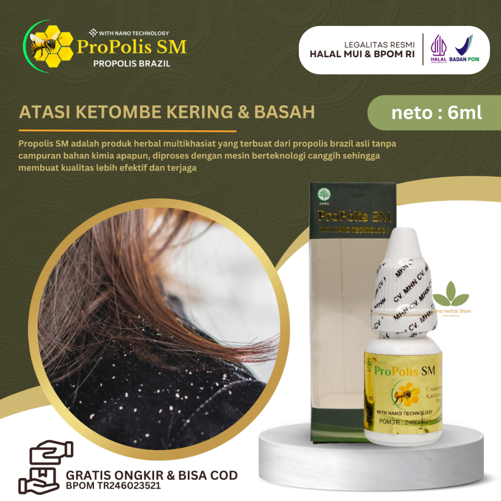 Propolis SM Obat Kepala Gatal Ketombean, Obat Ketombe Basah, Obat Penghilang Ketombe Parah, Obat Ket