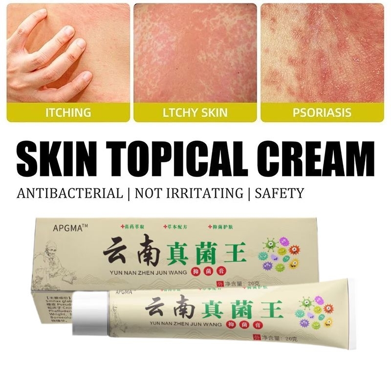 Salep Yunnan Krim Hijau Obat Kulit Gatal Ruam Jamur Kudis dan Kurap PICC Original Salep Alergi Antib