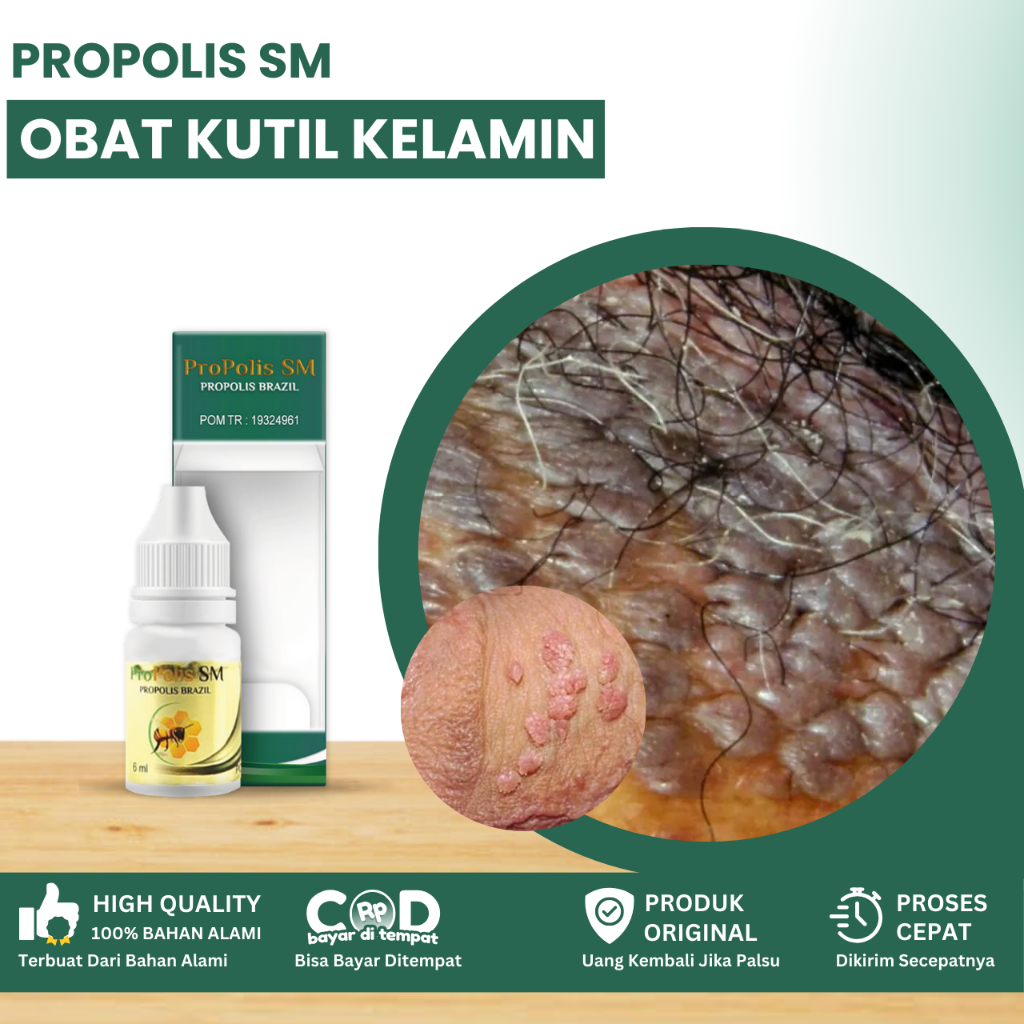 Obat Kutil Kelamin Pria Dan Wanita, Obat Kutil Hpv, Obat Perontok Jengger Ayam, Obat Jamur Kelamin, 