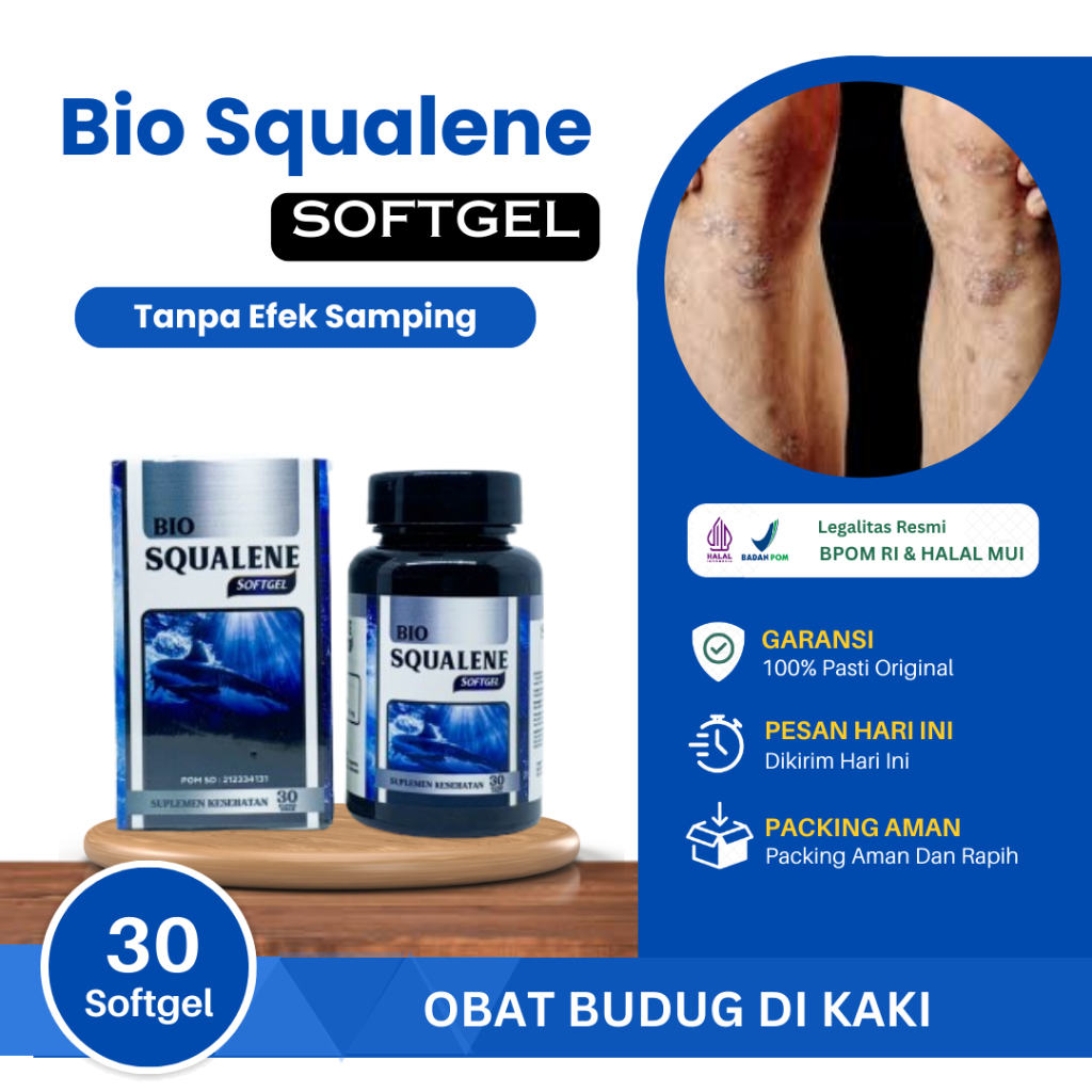 Obat Budug di Kaki, Budug dan Gatal, Budug Seluruh Badan, Budug Scabies Untuk Seluruh Badan, Penghil