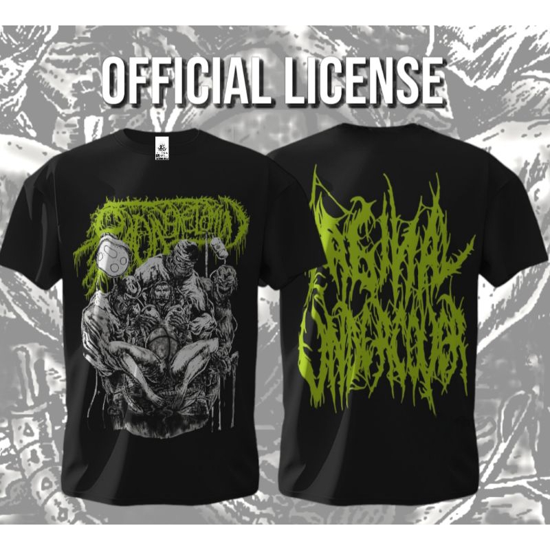 Ts Radang Kelamin - Vag*nal Undercover