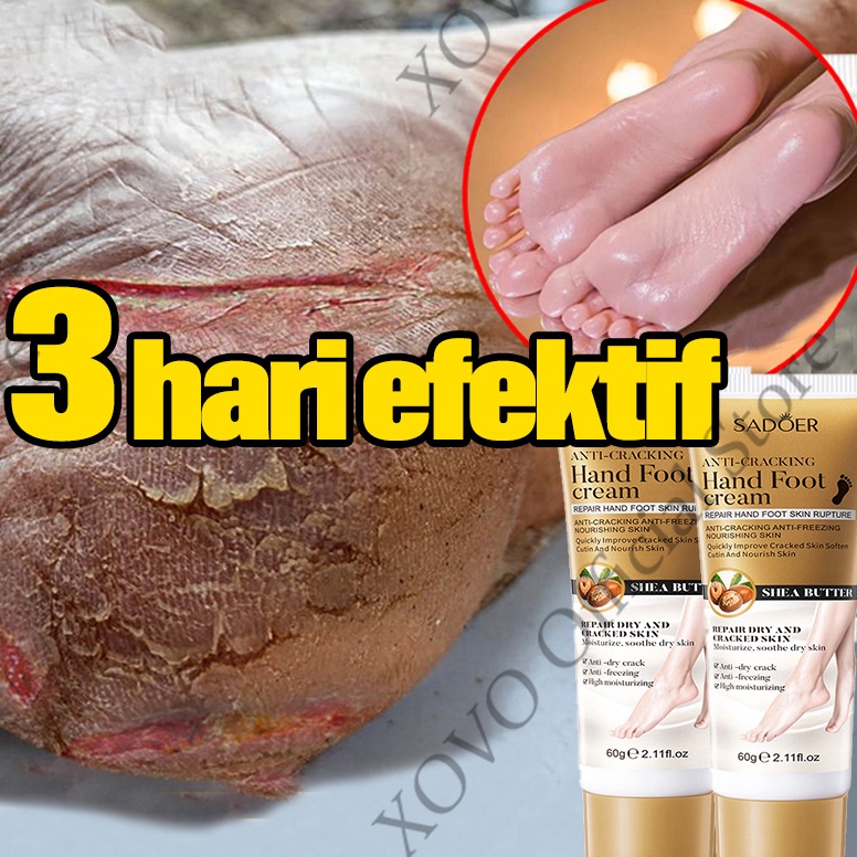 kaki obat kaki pecah dan kering krim obat kaki pecah pecah 6g alat kaki pecah pecah cream kaki pecah