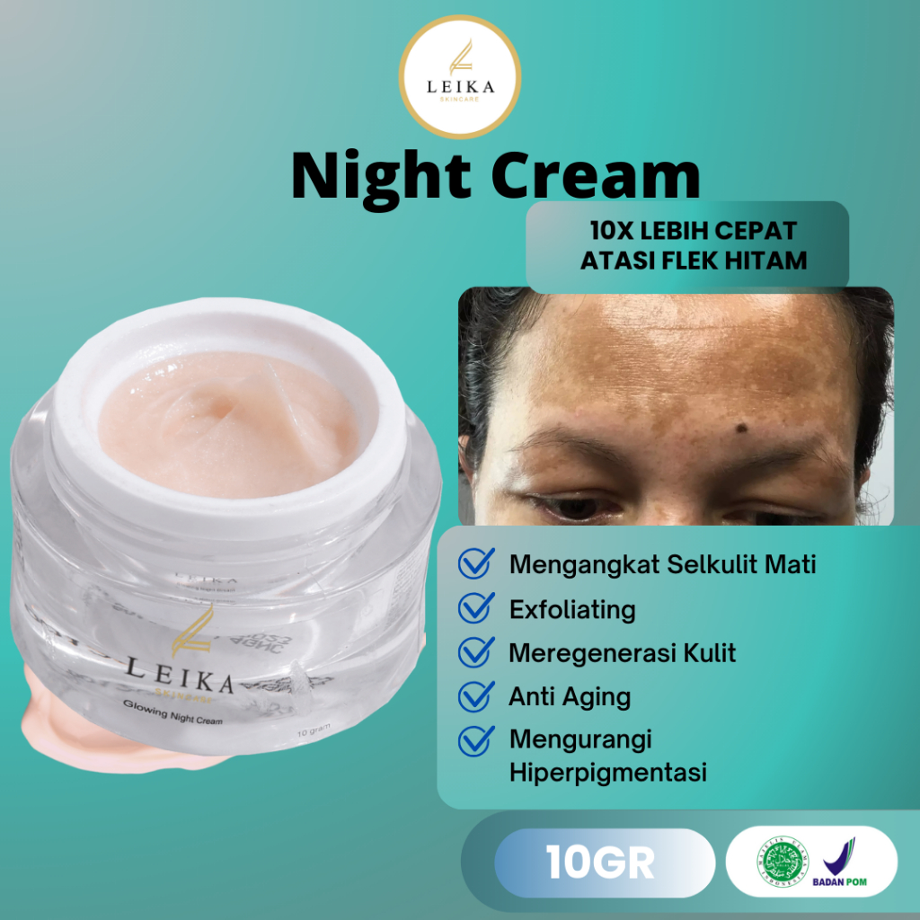 Night Cream Penghilang Flek hitam Ampuh bpom Penghilang Flek Tebal Cream Khusus Flek Hitam Di Wajah