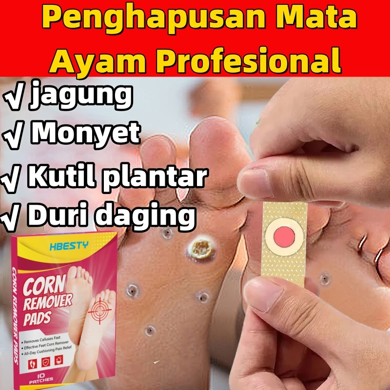 plester mata ikan patch mata ikan plester penghilang kutil plester kutil kapalan foot corn removal p