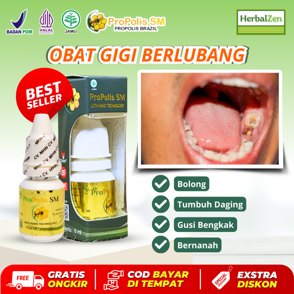 Obat Gigi Berlubang Bolong Tumbuh Daging Gusi Bengkak Bernanah Propolis Sm
