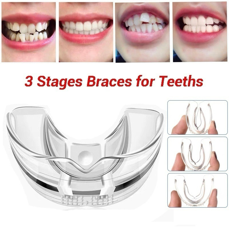 TINGXING Alat Perapi Gigi Dewasa Clear Aligner Teeth Braces Stage 3 Hard