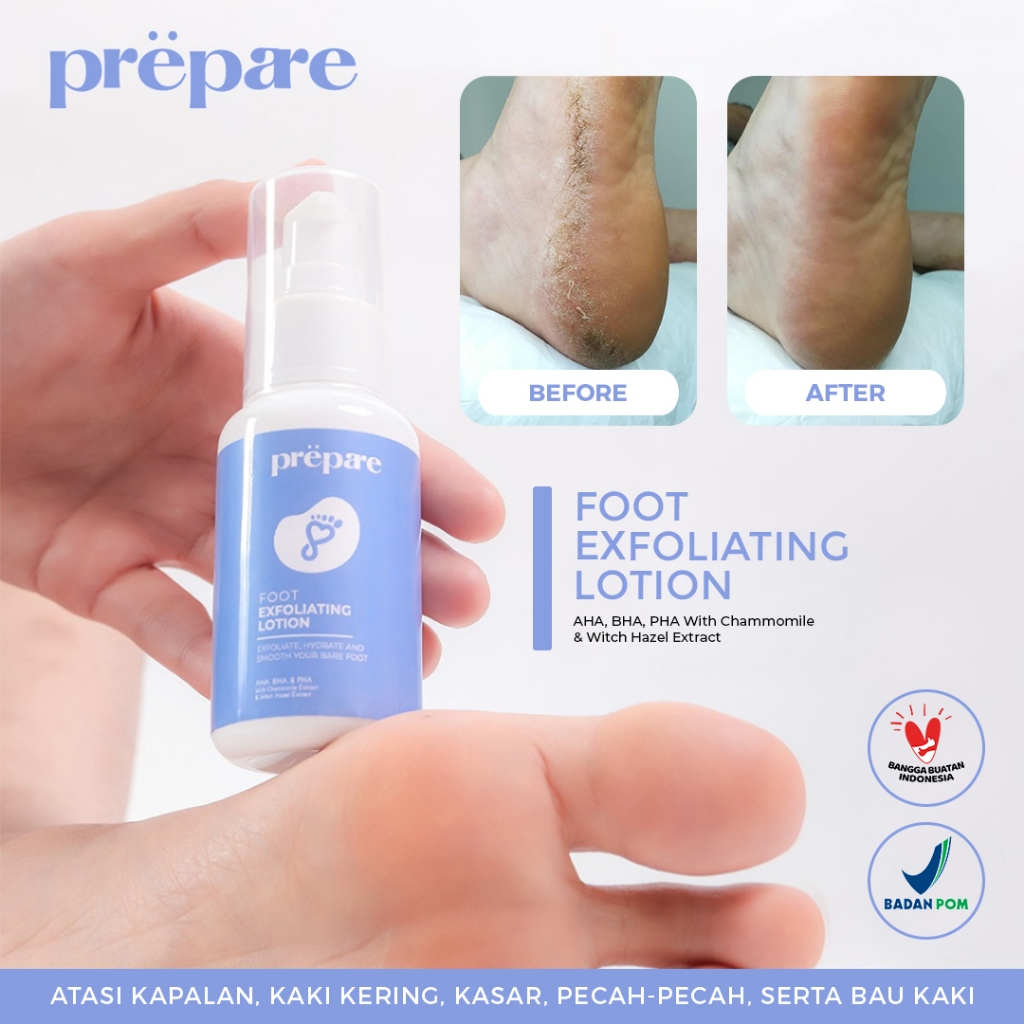 PREPARE Penghalus Tumit Kaki Tangan Kapalan Obat Kaki Pecah Pecah Penghalus Kaki Pecah dan Kering