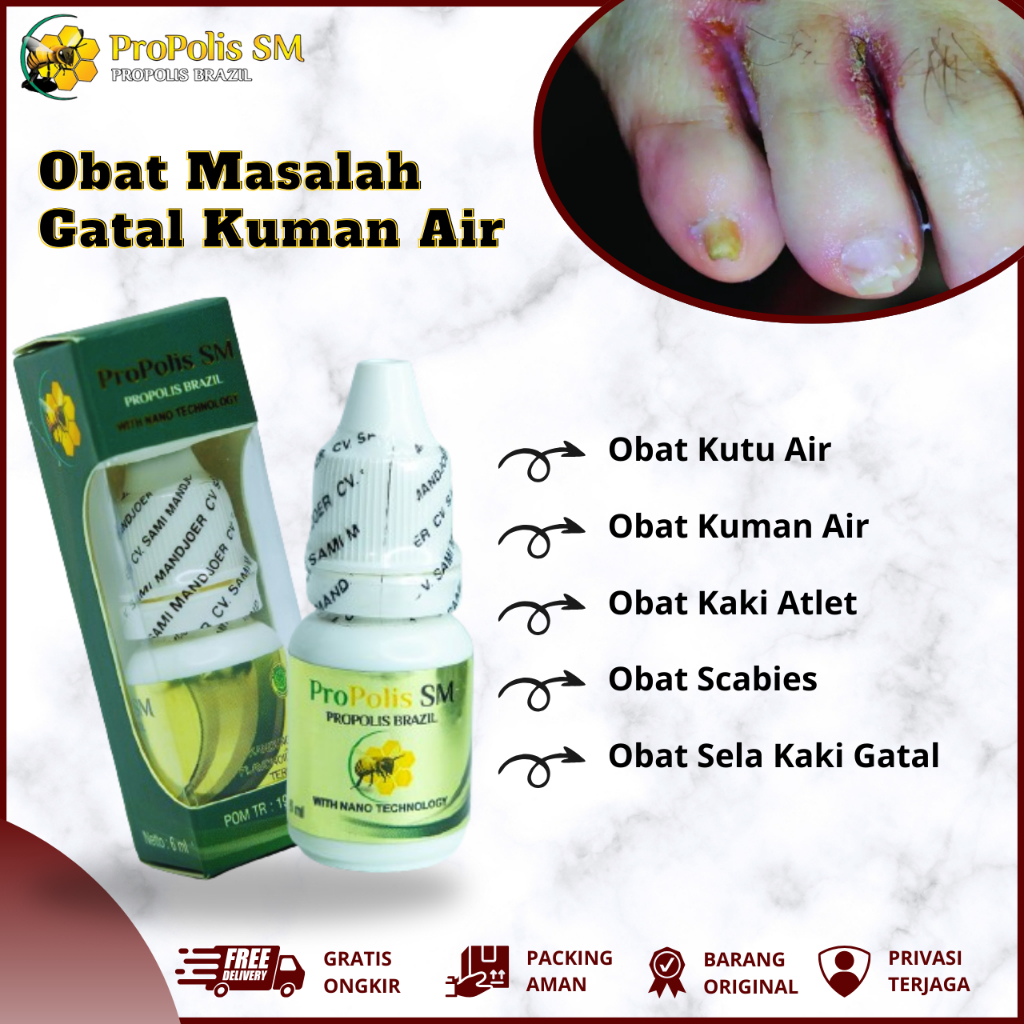 Obat Kutu Air, Obat Menghilangkan Kutu Air di Sela Jari, Obat Kutu Air Gatal, Obat Kuman Air, Obat K